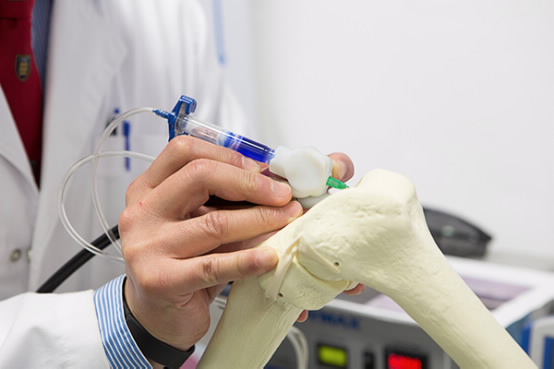 BioPen - Innowacyjna metoda wprowadzania implantów1
